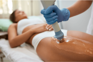 A woman is applying laser cellulite treatment to a client in an aesthetics clinic.